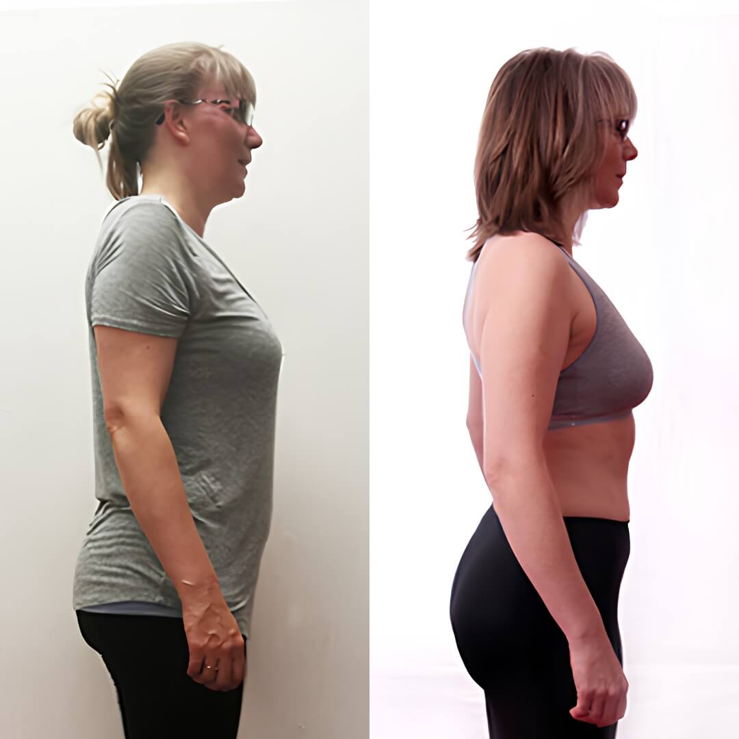 Jodie's progress photographs
